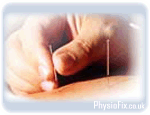 What is Acupuncture?